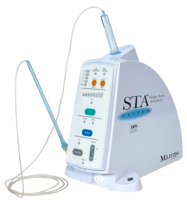 Single Tooth Anesthesia: The Wand